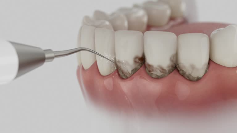 Reliable Dental contractor in Harrogate, TN by Smile Center Dentistry